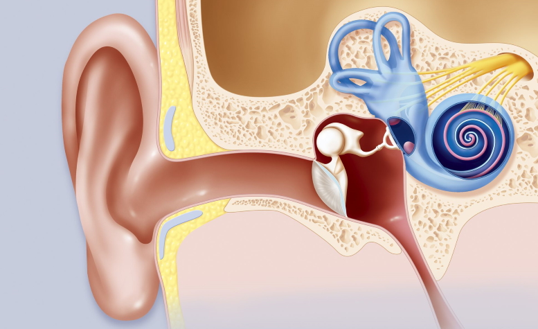 Vestibüler Migren, İşitme Kaybına Neden Olur mu?